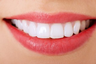 Zähne mit Veneer